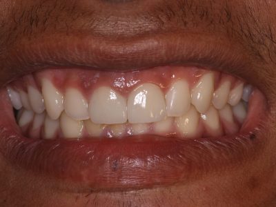 Gaurav Pikale IMG_3088