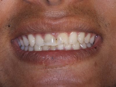 Gaurav Pikale b4 IMG_3007