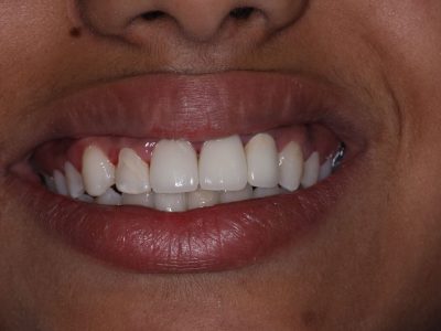 Harita Kundu after IMG_3212