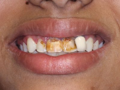 Harita Kundu b4 IMG_3167