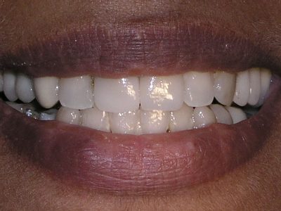 Jignasa Sheth after P3077452