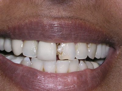 Jignasa Sheth b4 P2257409