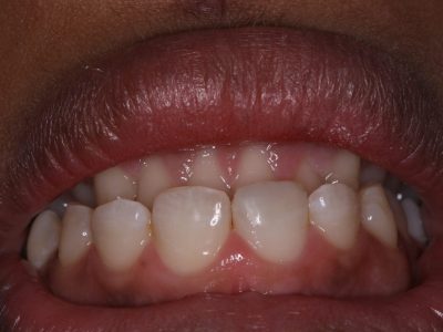 Kshitij Shrirangpur after IMG_3295