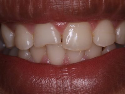 Kshitij Shrirangpur b4 IMG_3285