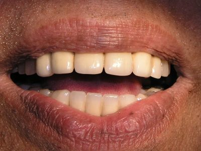 Mohan Kurade after PC309020