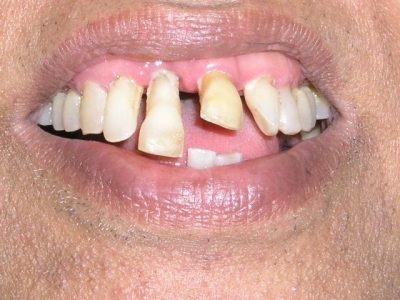 Mohan Kurade b4 P6140795