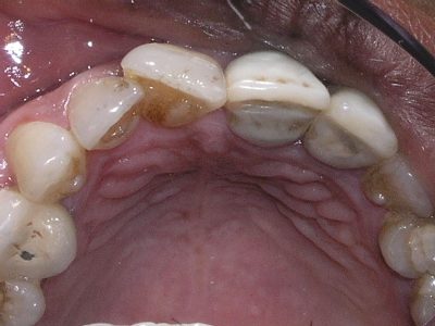 Rammohan Rai b4 P7306444