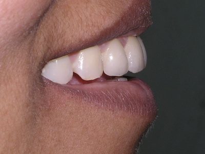 Rekha Pradeep After P6232934