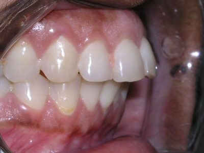 Rekha Pradeep b4 P6172875