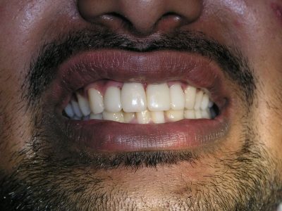 Sagar Dahiya after P9099134