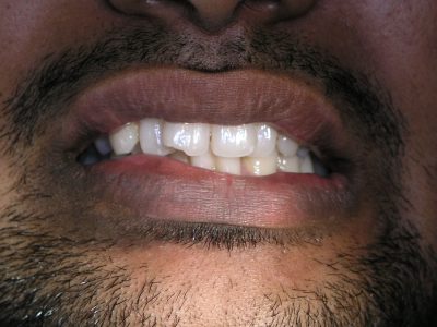 Sagar Dahiya b4 P7238988