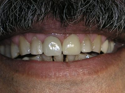 Subhash Awchat after P5018997