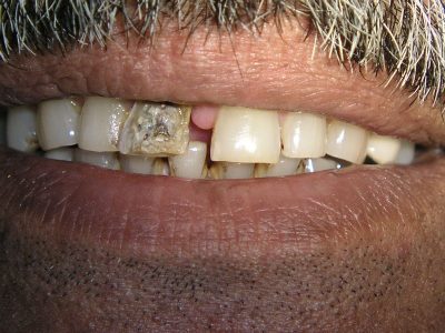 Subhash Awchat b4 P4178900